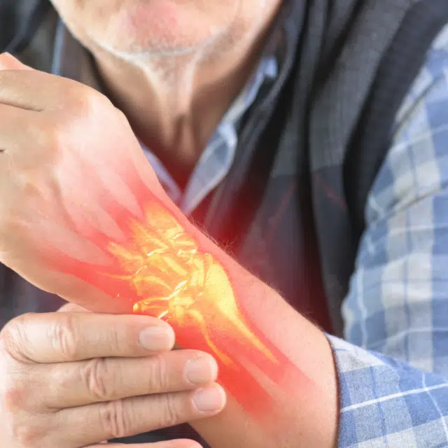 Mature Adult, Senior Adult, Joint - Body Part, Problems, Pain