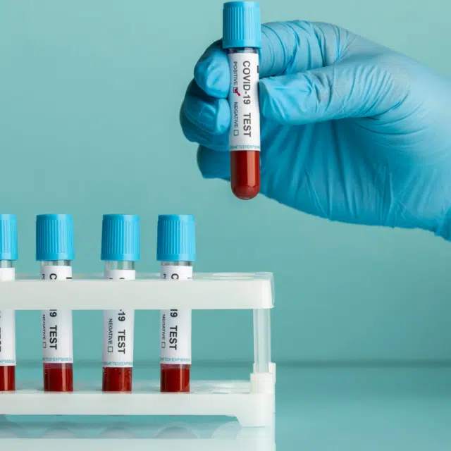 Why in-office Lab Tests Matter for Seniors